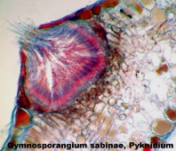 Pflanzenparasiten, Puccinia graminis